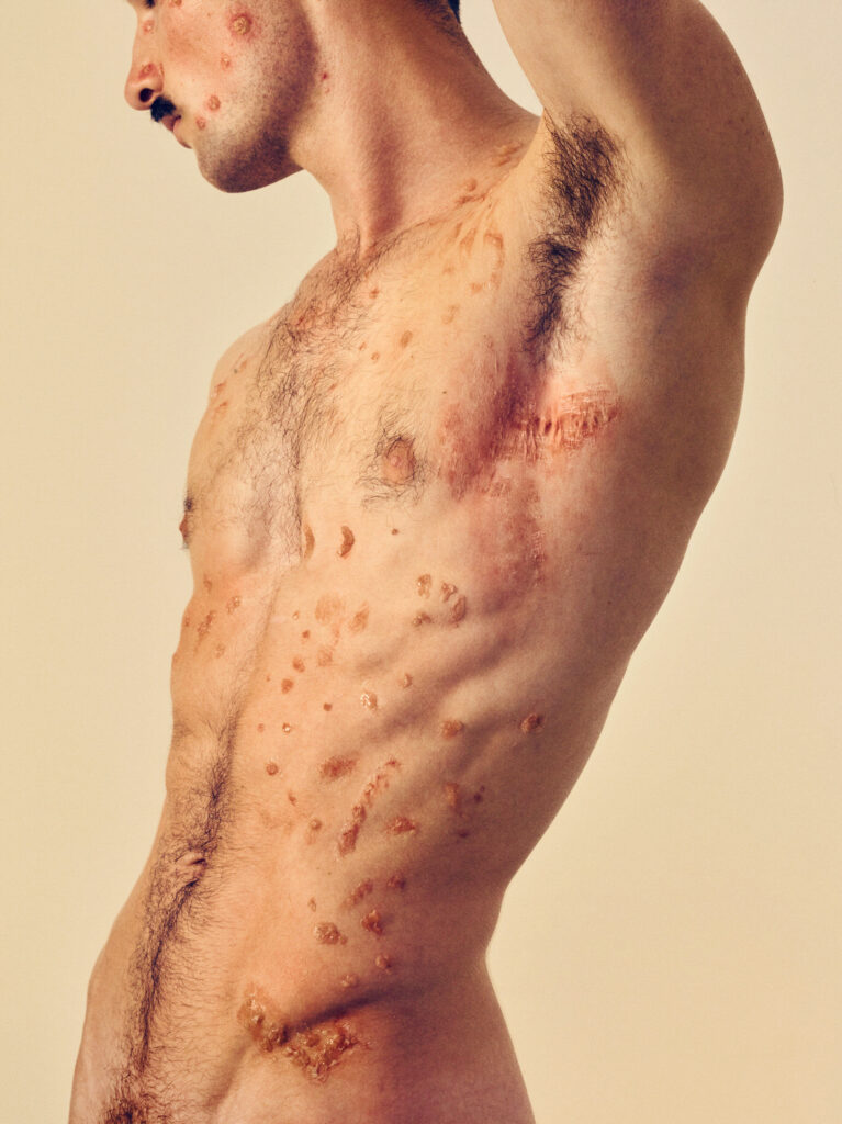 © Sebastian Nevols - Ben I