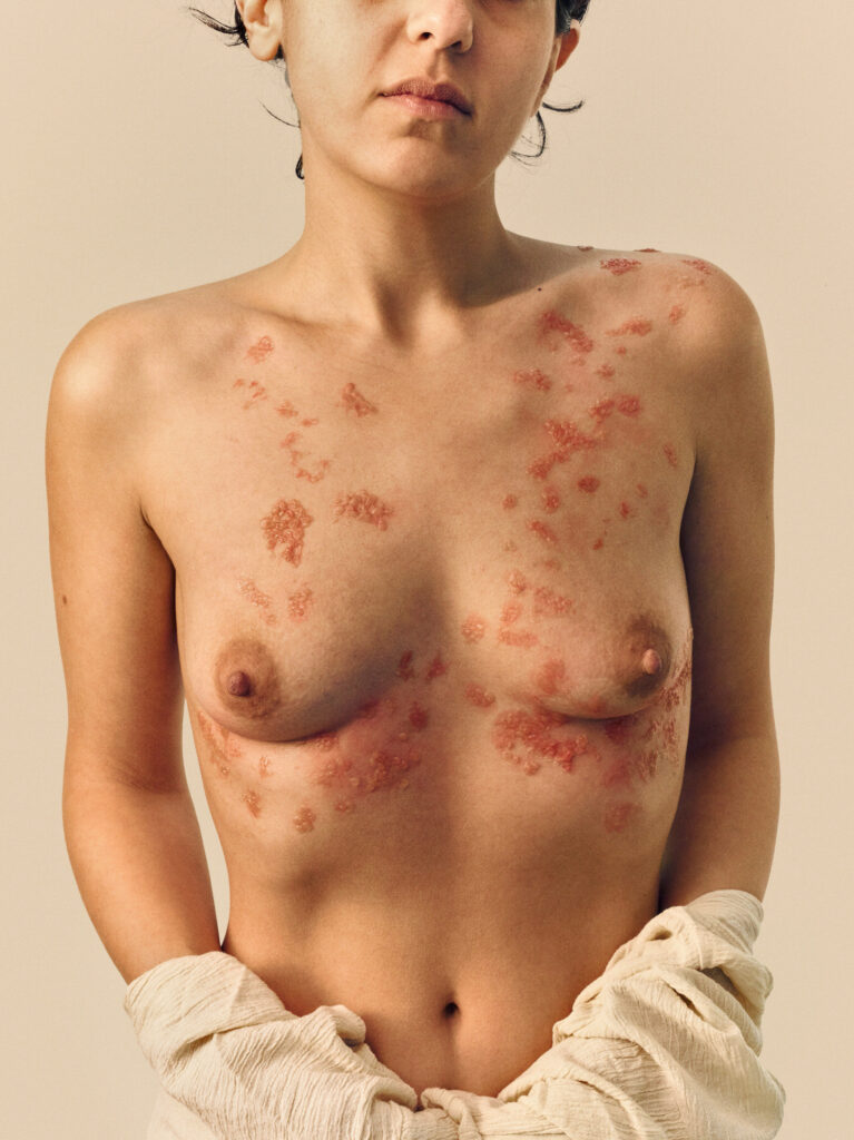 © Sebastian Nevols - Golcher I