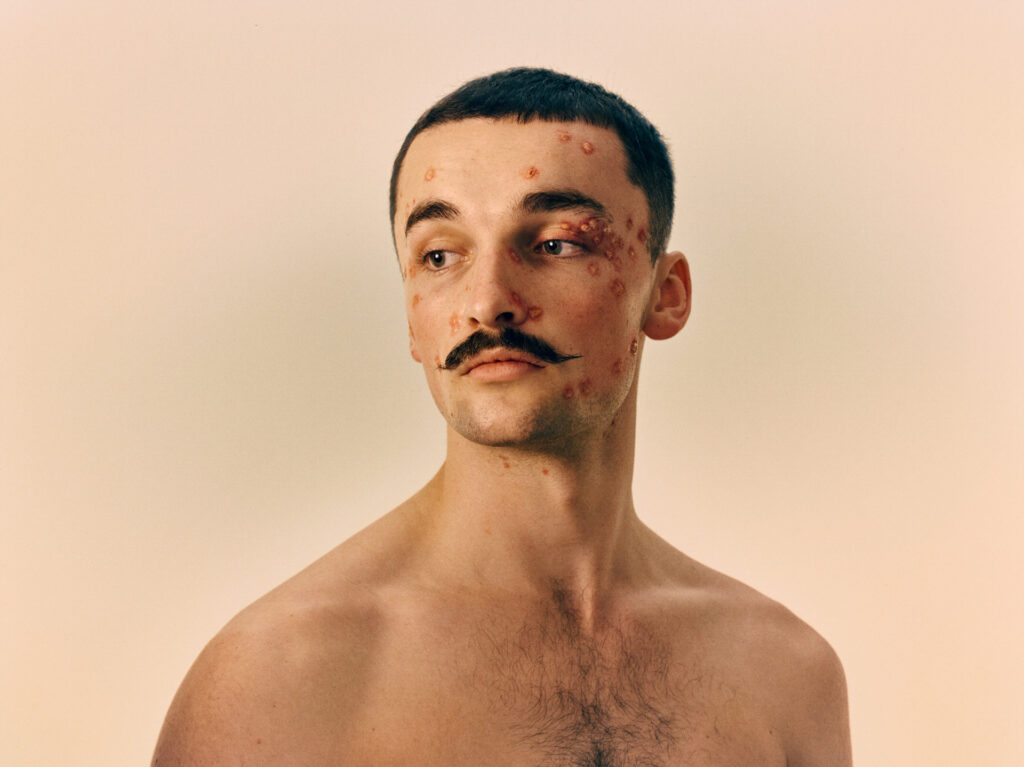 © Sebastian Nevols - Ben II
